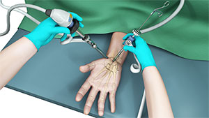 Elective Emergency Hand Surgery