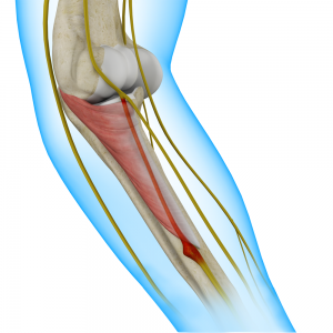 Radial Tunnel Syndrome