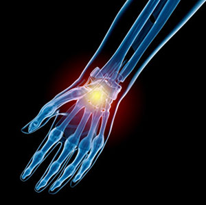 Sports Injury Management of Hand, Wrist & Elbow