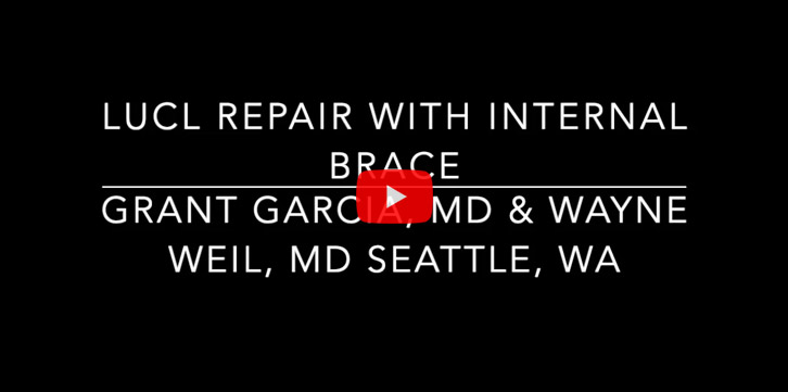 LUCL Repair with Internal Brace